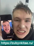 Фото зубов пациента медцентра Жуйкан в Китае